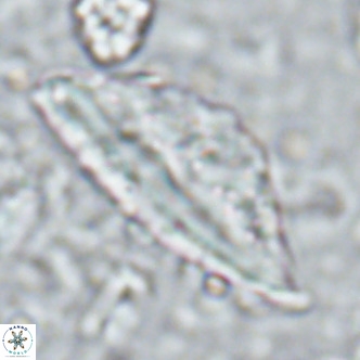 Pennalithus rugosus VR 16446