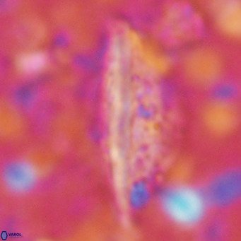 Pennalithus rugosus VR 16454