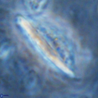 Pennalithus rugosus VR 16458