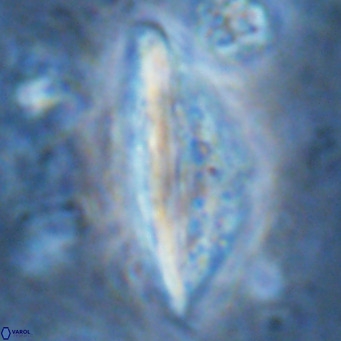 Pennalithus rugosus VR 16459