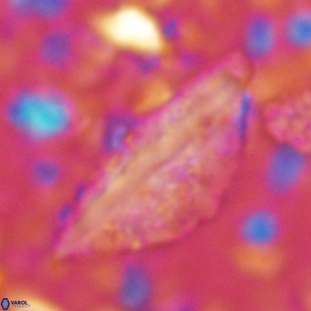 Pennalithus rugosus VR 16450