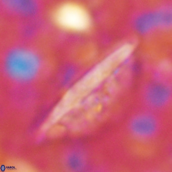 Pennalithus rugosus VR 16452