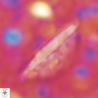 Pennalithus rugosus VR 16452