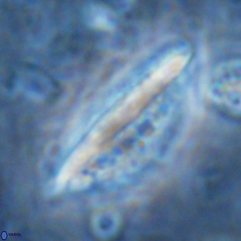 Pennalithus rugosus VR 16461