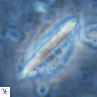 Pennalithus rugosus VR 16461
