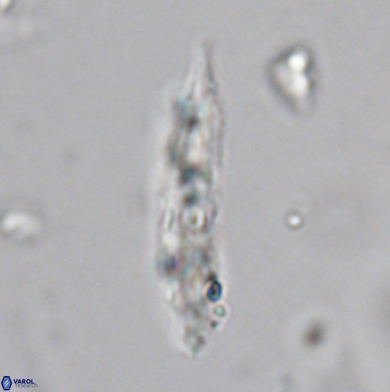 Pennalithus rugosus VR 18756