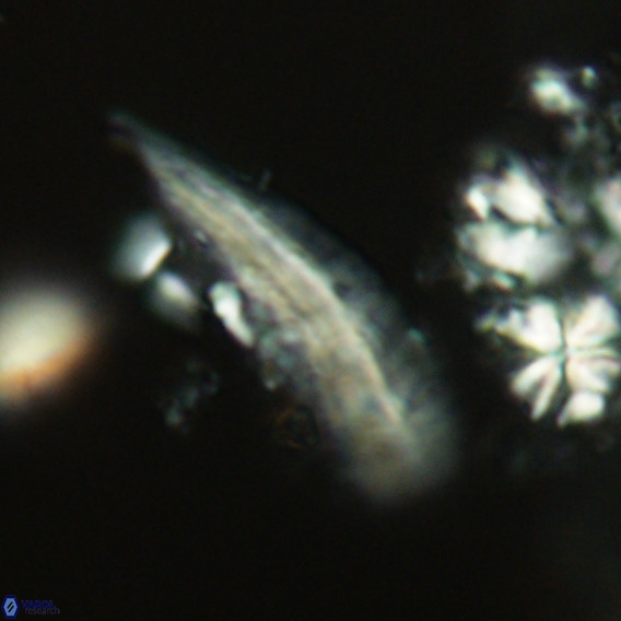 Pennalithus rugosus VR 18784