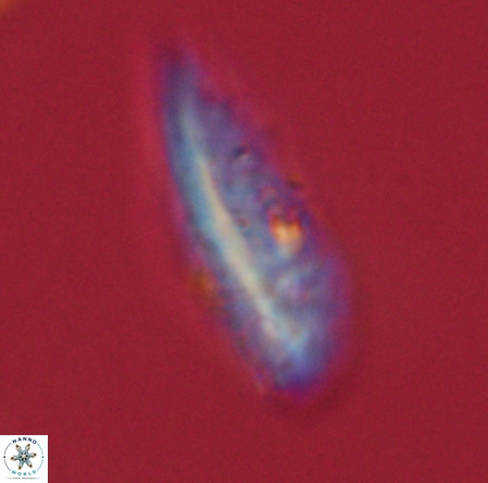 Pennalithus rugosus VR 19058