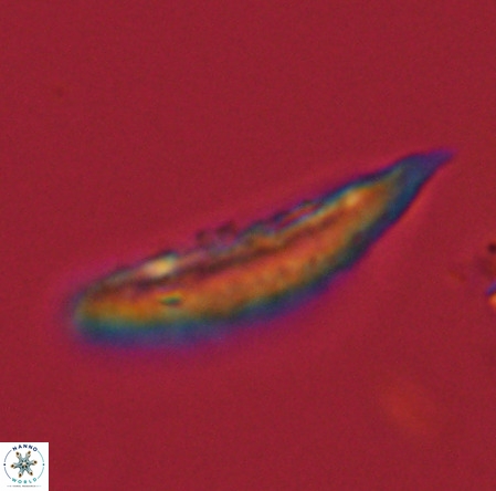 Pennalithus rugosus VR 19072