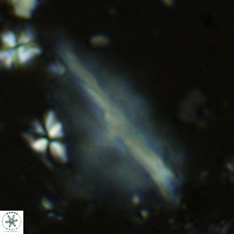 Pennalithus rugosus VR 10055