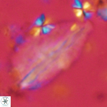 Pennalithus rugosus VR 10058