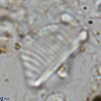 Pennalithus rugosus VR 10385