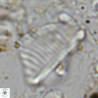 Pennalithus rugosus VR 10385