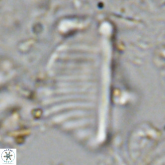 Pennalithus rugosus VR 10387