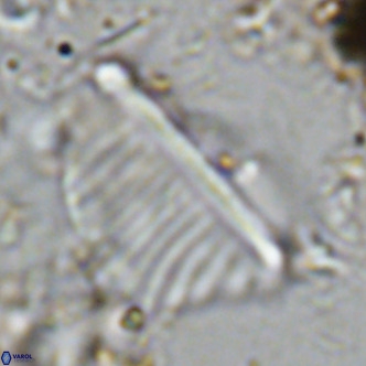 Pennalithus rugosus VR 10388