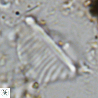 Pennalithus rugosus VR 10388