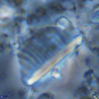 Pennalithus rugosus VR 10398