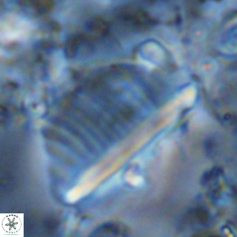 Pennalithus rugosus VR 10398