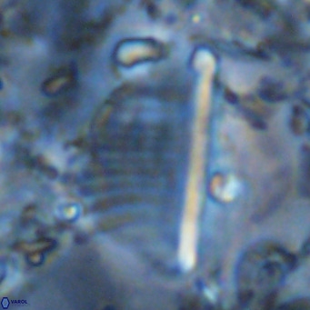 Pennalithus rugosus VR 10399