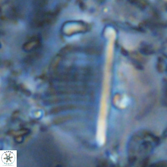 Pennalithus rugosus VR 10399