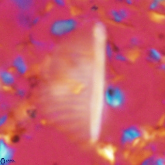 Pennalithus rugosus VR 10392