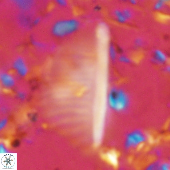 Pennalithus rugosus VR 10392