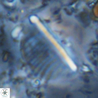 Pennalithus rugosus VR 10400