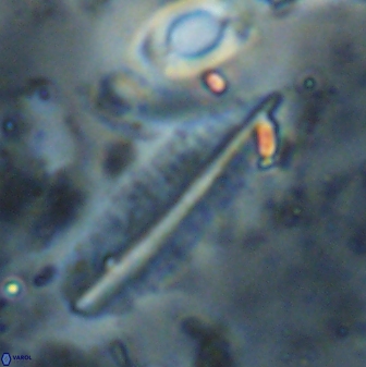 Pennalithus rugosus 29756