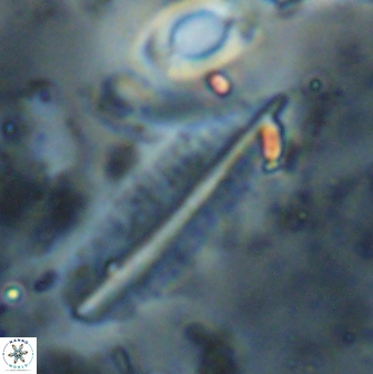 Pennalithus rugosus 29756