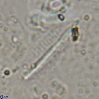 Pennalithus rugosus 29757