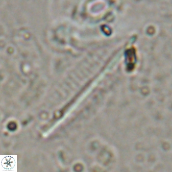 Pennalithus rugosus 29757