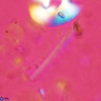 Pennalithus rugosus 29759