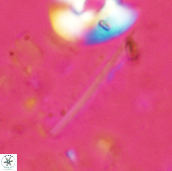 Pennalithus rugosus 29759