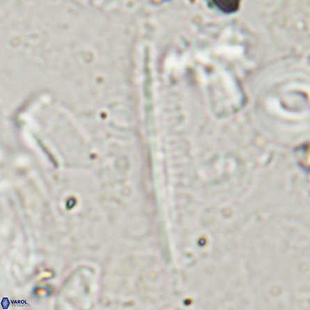 Pennalithus rugosus 29767