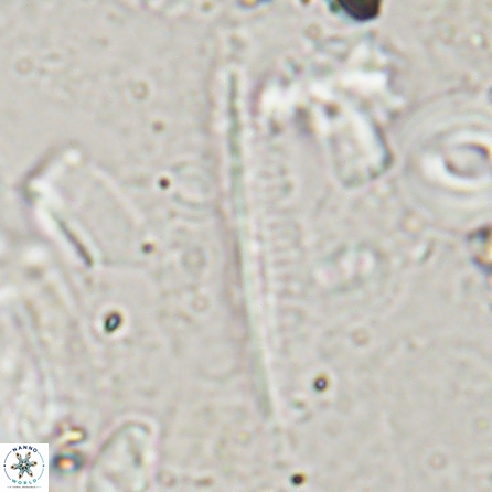 Pennalithus rugosus 29767