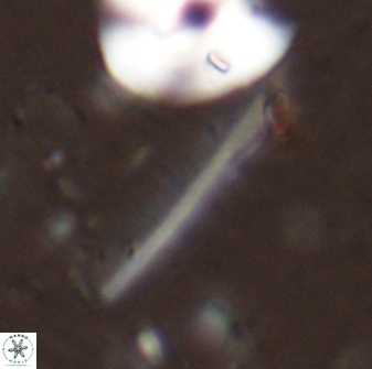 Pennalithus rugosus 29760