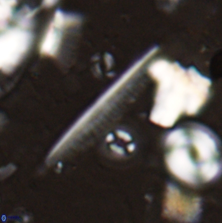 Pennalithus rugosus 29763