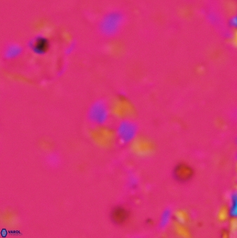 Pedinocyclus jafari 648