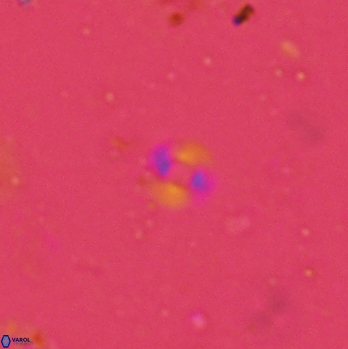 Pedinocyclus jafarii 2435