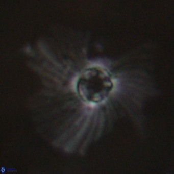 Pedinocyclus larvalis VR 30810