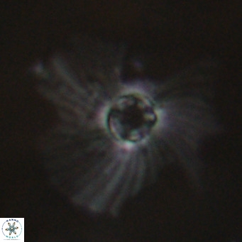 Pedinocyclus larvalis VR 30810
