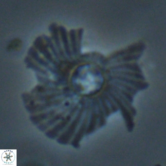 Pedinocyclus larvalis VR 30813