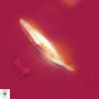 Pedinocyclus larvalis VR 30823