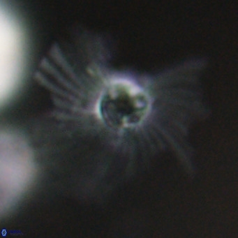 Pedinocyclus larvalis VR 30825
