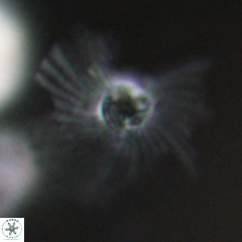 Pedinocyclus larvalis VR 30825