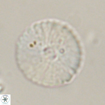 Pedinocyclus larvalsi VR 34348