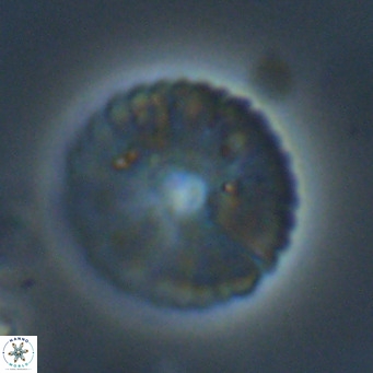 Pedinocyclus larvalsi VR 34349