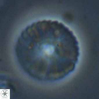 Pedinocyclus larvalsi VR 34350