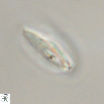 Pedinocyclus larvalsi VR 34355