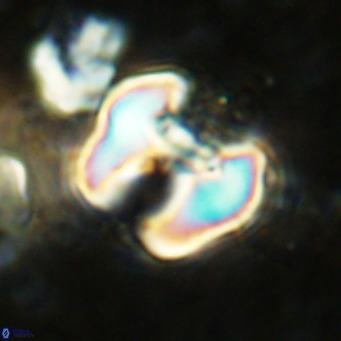 Perchnielsenella ismailkoselii VR 11402